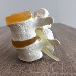 Fysiotherapie de Oversteek rugklachten pijn Nijmegen Oosterhout