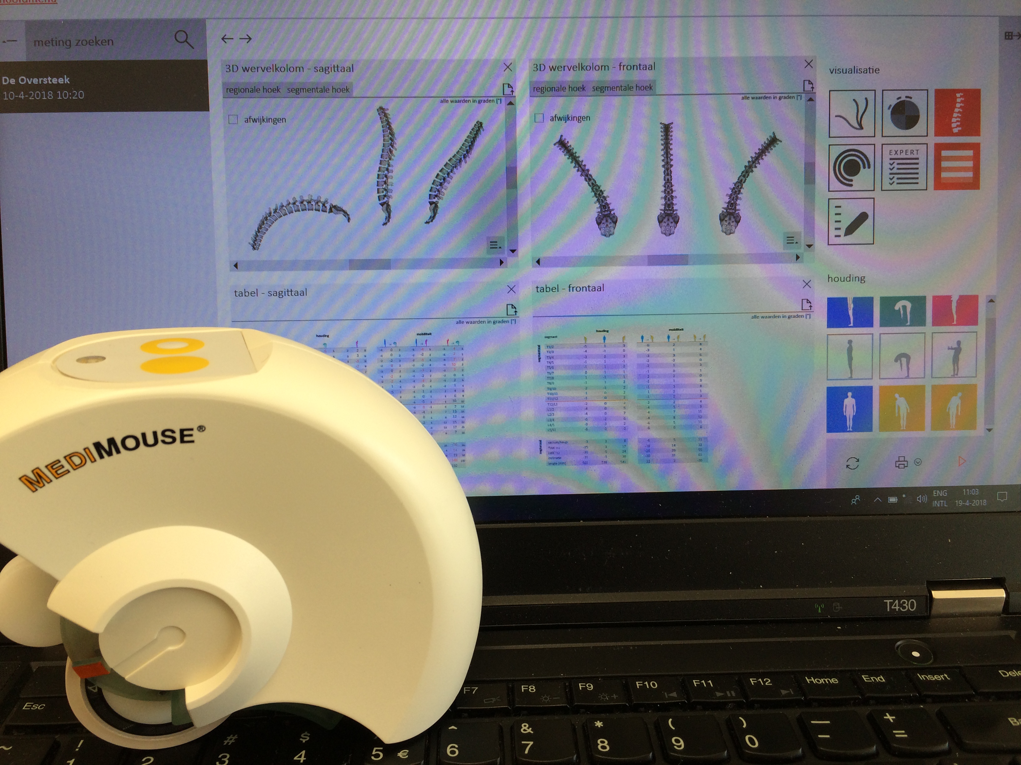 Medi Mouse Nijmegen Noord Fysiotherapie de oversteek scan pijn Oosterhout
