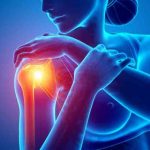 Fysiotherapie_de_Oversteek_schouderpijn