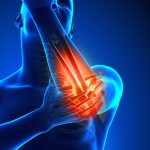 Fysiotherapie_de_Oversteek_elleboog_pijn