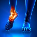 Fysiotherapie_de_Oversteek_enkelklachten