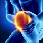 Fysiotherapie_de_Oversteek_kniepijn