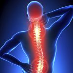 Fysiotherapie_de_Oversteek_rugpijn