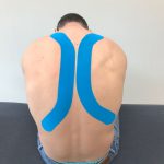 Fysiotherapie_de_Oversteek_Medical_Taping