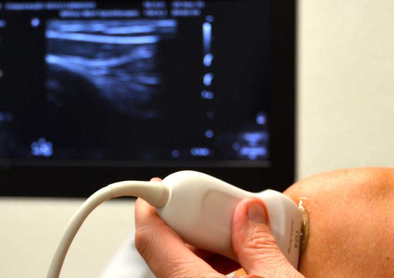 Fysiotherapie_de_Oversteek_Nijmegen_Noord_Echografie