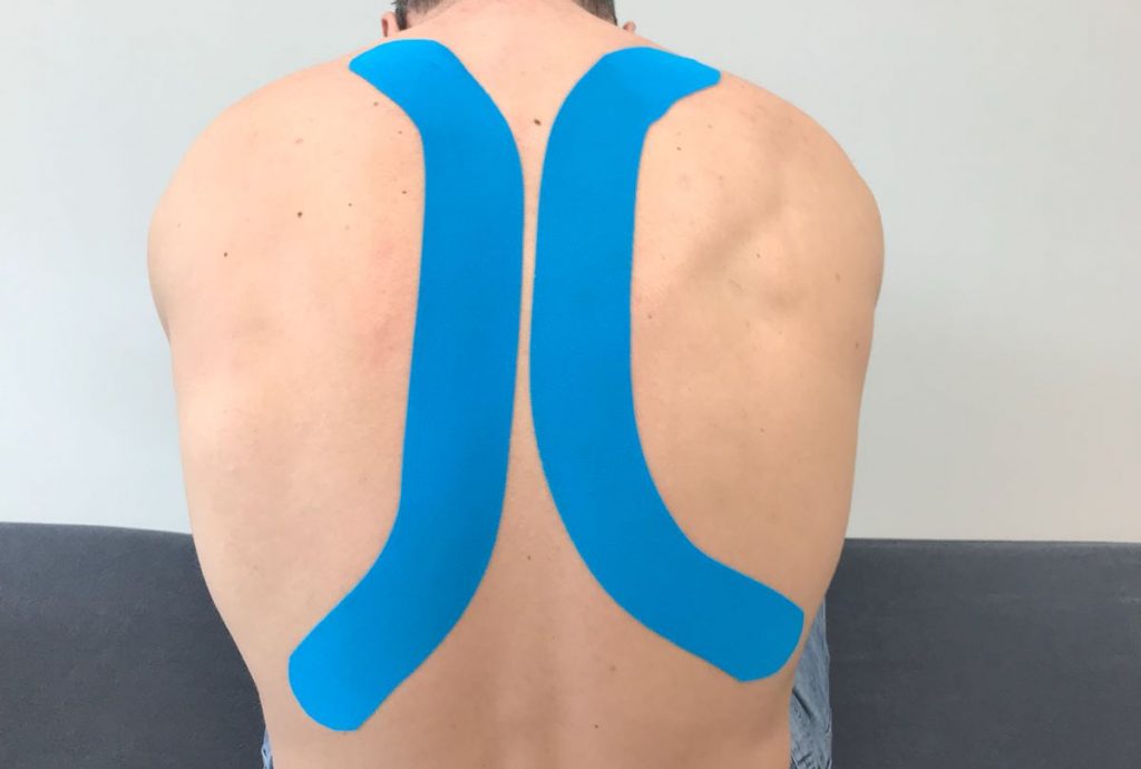 Fysiotherapie_de_Oversteek_Medical_Taping Fysiotherapie_de_Oversteek_Medical_Taping