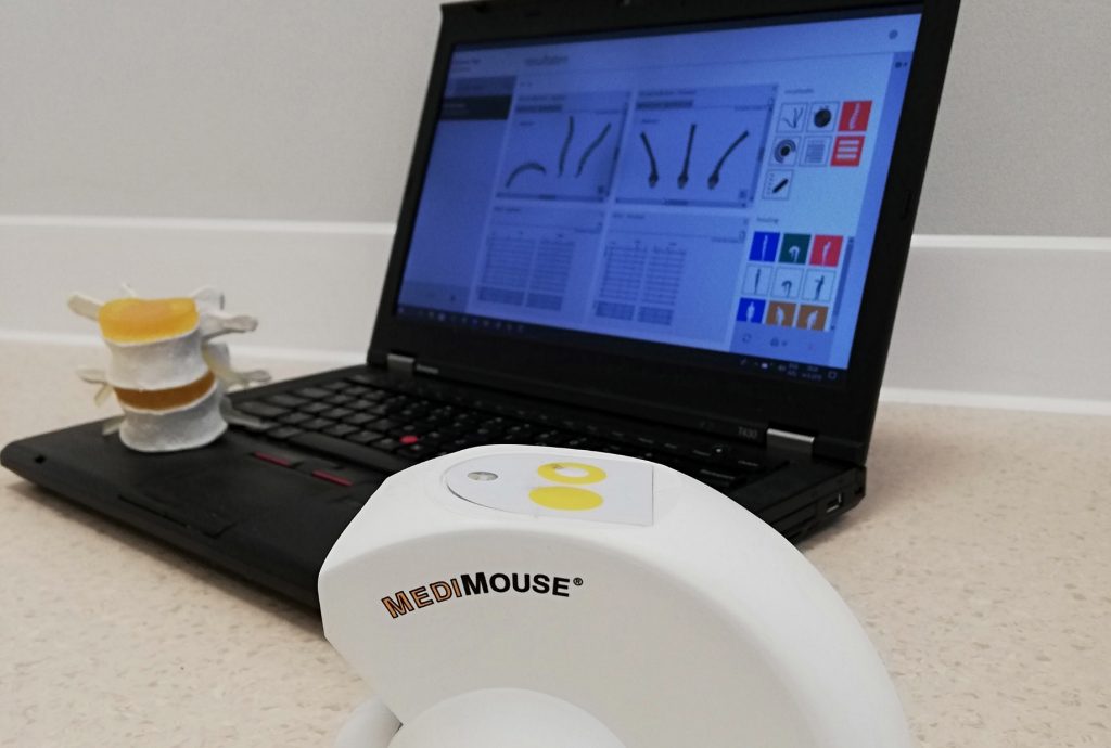 Medimouse Fysiotherapie_de_Oversteek_Nijmegen_Noord_Spinal_Mouse_Medimouse_rugadvies